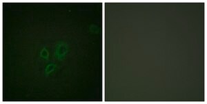 Anti-Tnni3, N-Terminal antibody produced in rabbit affinity isolated antibody
