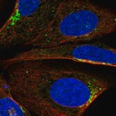 Anti-PIK3R2 antibody produced in rabbit Prestige Antibodies&#174; Powered by Atlas Antibodies, affinity isolated antibody