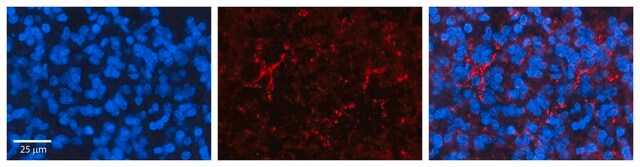 Anti-SLC1A4 antibody produced in rabbit affinity isolated antibody