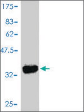 Monoclonal Anti-ROR1 antibody produced in mouse clone 2F8, purified immunoglobulin, buffered aqueous solution