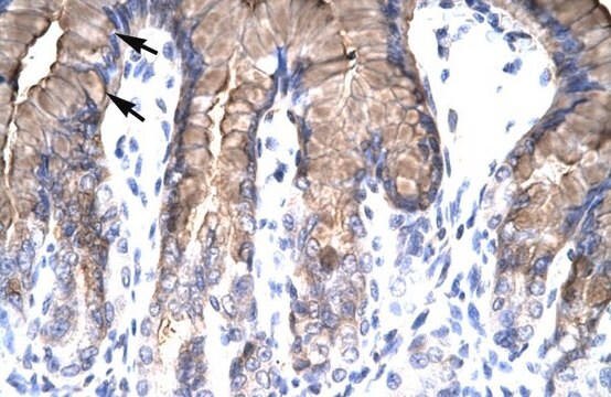 Anti-NR4A1 (N-terminal) antibody produced in rabbit affinity isolated antibody