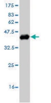 ANTI-OTX1 antibody produced in mouse clone 4E5, purified immunoglobulin, buffered aqueous solution