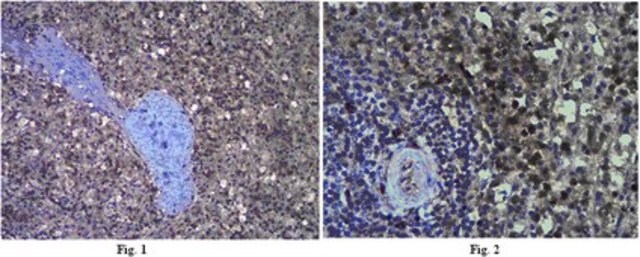 Anti-Interleukin-18 (IL-18) Antibody from rabbit, purified by affinity chromatography