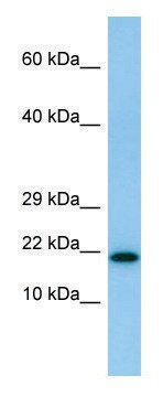 Anti-IL26 (N-terminal) antibody produced in rabbit affinity isolated antibody