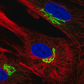 Anti-ARL1 antibody produced in rabbit Prestige Antibodies&#174; Powered by Atlas Antibodies, affinity isolated antibody