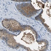 Anti-PDE9A antibody produced in rabbit Prestige Antibodies&#174; Powered by Atlas Antibodies, affinity isolated antibody, buffered aqueous glycerol solution