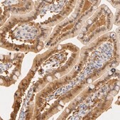 Anti-CA2 antibody produced in rabbit Prestige Antibodies&#174; Powered by Atlas Antibodies, affinity isolated antibody, buffered aqueous glycerol solution