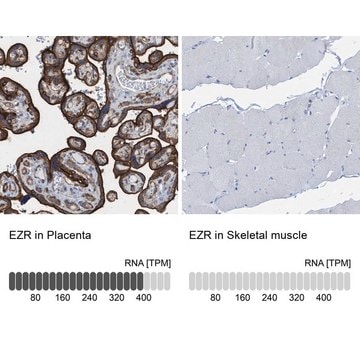 Anti-EZR antibody produced in rabbit Prestige Antibodies&#174; Powered by Atlas Antibodies, affinity isolated antibody, buffered aqueous glycerol solution