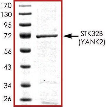 STK32B active, GST tagged human PRECISIO&#174; Kinase, recombinant, expressed in baculovirus infected Sf9 cells, &#8805;70% (SDS-PAGE), buffered aqueous glycerol solution