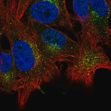 Anti-ABHD6 antibody produced in rabbit Prestige Antibodies&#174; Powered by Atlas Antibodies, affinity isolated antibody
