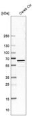 Anti-PDE1B antibody produced in rabbit Prestige Antibodies&#174; Powered by Atlas Antibodies, affinity isolated antibody, buffered aqueous glycerol solution