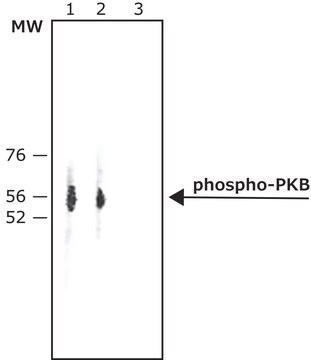 Anti-phospho-PKB (pThr308) antibody produced in rabbit IgG fraction of antiserum, buffered aqueous solution