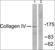 Anti-Collagen IV antibody produced in rabbit affinity isolated antibody