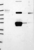 Anti-FGG antibody produced in rabbit Prestige Antibodies&#174; Powered by Atlas Antibodies, affinity isolated antibody, buffered aqueous glycerol solution