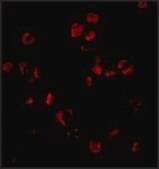 Anti-Sumo antibody produced in rabbit affinity isolated antibody, buffered aqueous solution