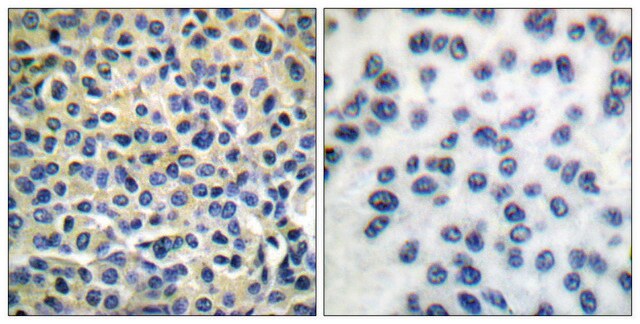 Anti-LIMK1 antibody produced in rabbit affinity isolated antibody