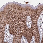 Anti-PRKCH antibody produced in rabbit Prestige Antibodies&#174; Powered by Atlas Antibodies, affinity isolated antibody, buffered aqueous glycerol solution