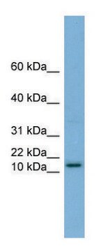 Anti-HRK (N-terminal) antibody produced in rabbit affinity isolated antibody