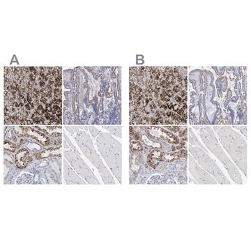 Anti-SGSH antibody produced in rabbit Prestige Antibodies&#174; Powered by Atlas Antibodies, affinity isolated antibody, buffered aqueous glycerol solution, Ab1