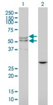 Monoclonal Anti-LIPA antibody produced in mouse clone 1F9, purified immunoglobulin, buffered aqueous solution