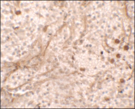 Anti-PIBF1 antibody produced in rabbit affinity isolated antibody