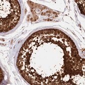 Anti-IMPA1 antibody produced in rabbit Prestige Antibodies&#174; Powered by Atlas Antibodies, affinity isolated antibody, buffered aqueous glycerol solution