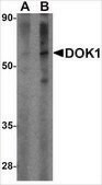 Anti-DOK1 antibody produced in rabbit affinity isolated antibody, buffered aqueous solution