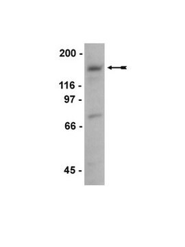 Anti-KIF21A Antibody Upstate&#174;, from rabbit