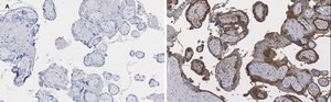 Anti-BCRP (ABCG2) Antibody, clone 10K5 , ZooMAb&#174; Rabbit Monoclonal recombinant, expressed in HEK 293 cells