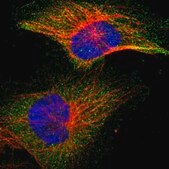 Anti-IKBKB antibody produced in rabbit Prestige Antibodies&#174; Powered by Atlas Antibodies, affinity isolated antibody, buffered aqueous glycerol solution