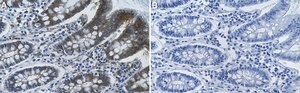 Anti-VHL Antibody, clone 1C10 ZooMAb&#174; Rabbit Monoclonal recombinant, expressed in HEK 293 cells