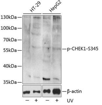 Anti-Phospho-CHEK1-S345 antibody produced in rabbit