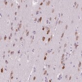 Anti-ELAVL2 antibody produced in rabbit Prestige Antibodies&#174; Powered by Atlas Antibodies, affinity isolated antibody, buffered aqueous glycerol solution