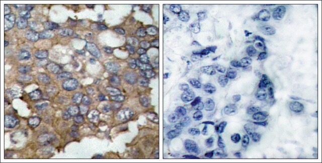 Anti-SRC (Ab-529) antibody produced in rabbit affinity isolated antibody