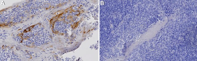 Anti-S1PR2 Antibody, clone 1C18 ZooMAb&#174; Rabbit Monoclonal recombinant, expressed in HEK 293 cells