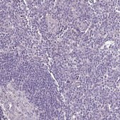 Anti-HTRA4 antibody produced in rabbit Prestige Antibodies&#174; Powered by Atlas Antibodies, affinity isolated antibody, buffered aqueous glycerol solution