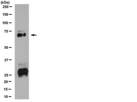 Anti-Vitamin K dependent protein S Antibody from rabbit, purified by affinity chromatography