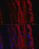Anti-alpha smooth muscle actin antibody produced in rabbit