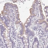 Anti-TREH antibody produced in rabbit Prestige Antibodies&#174; Powered by Atlas Antibodies, affinity isolated antibody, buffered aqueous glycerol solution