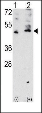 ANTI-VEGFC (VEGF3) (CENTER M263) antibody produced in rabbit IgG fraction of antiserum, buffered aqueous solution