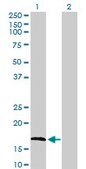 Anti-FGF1 antibody produced in rabbit purified immunoglobulin, buffered aqueous solution