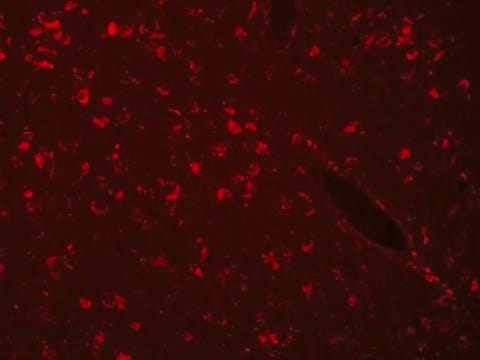 Autofluorescence Eliminator Reagent Autofluorescence Eliminator Reagent for IHC.