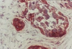Anti-PTEN Antibody, CT, clone A2b1 clone A2b1, Chemicon&#174;, from mouse