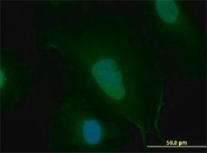 Monoclonal Anti-MYC antibody produced in mouse clone 1G7, purified immunoglobulin, buffered aqueous solution