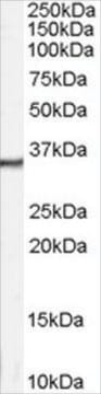 Anti-Calretinin antibody produced in goat affinity isolated antibody, buffered aqueous solution