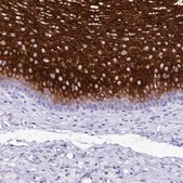 Anti-A2ML1 antibody produced in rabbit Prestige Antibodies&#174; Powered by Atlas Antibodies, affinity isolated antibody, buffered aqueous glycerol solution