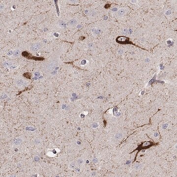 Anti-TAC1 antibody produced in rabbit Prestige Antibodies&#174; Powered by Atlas Antibodies, affinity isolated antibody, buffered aqueous glycerol solution
