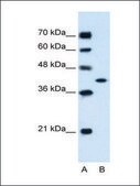 Anti-GOT2 (AB2) antibody produced in rabbit IgG fraction of antiserum