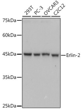 Anti-Erlin-2 Antibody, clone 9T3M5, Rabbit Monoclonal