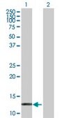 Anti-HBZ antibody produced in rabbit purified immunoglobulin, buffered aqueous solution